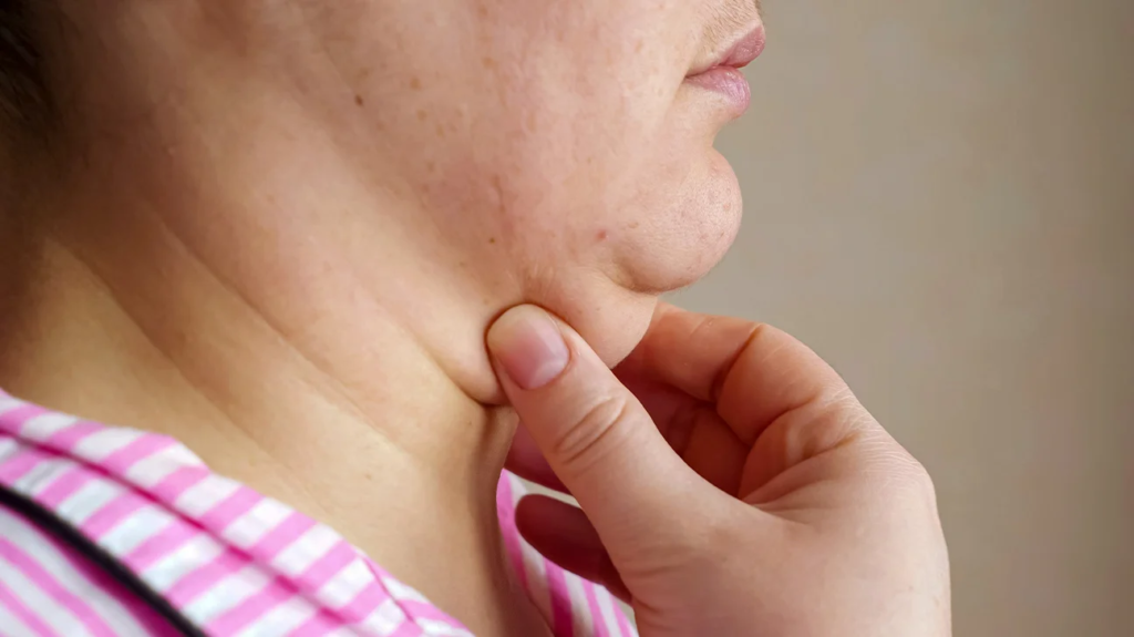 Effective Double Chin Treatment in Andheri: Achieve a Sculpted Jawline